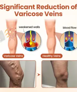 VitaCuroK™ -VeinTarget Microneedle Patch